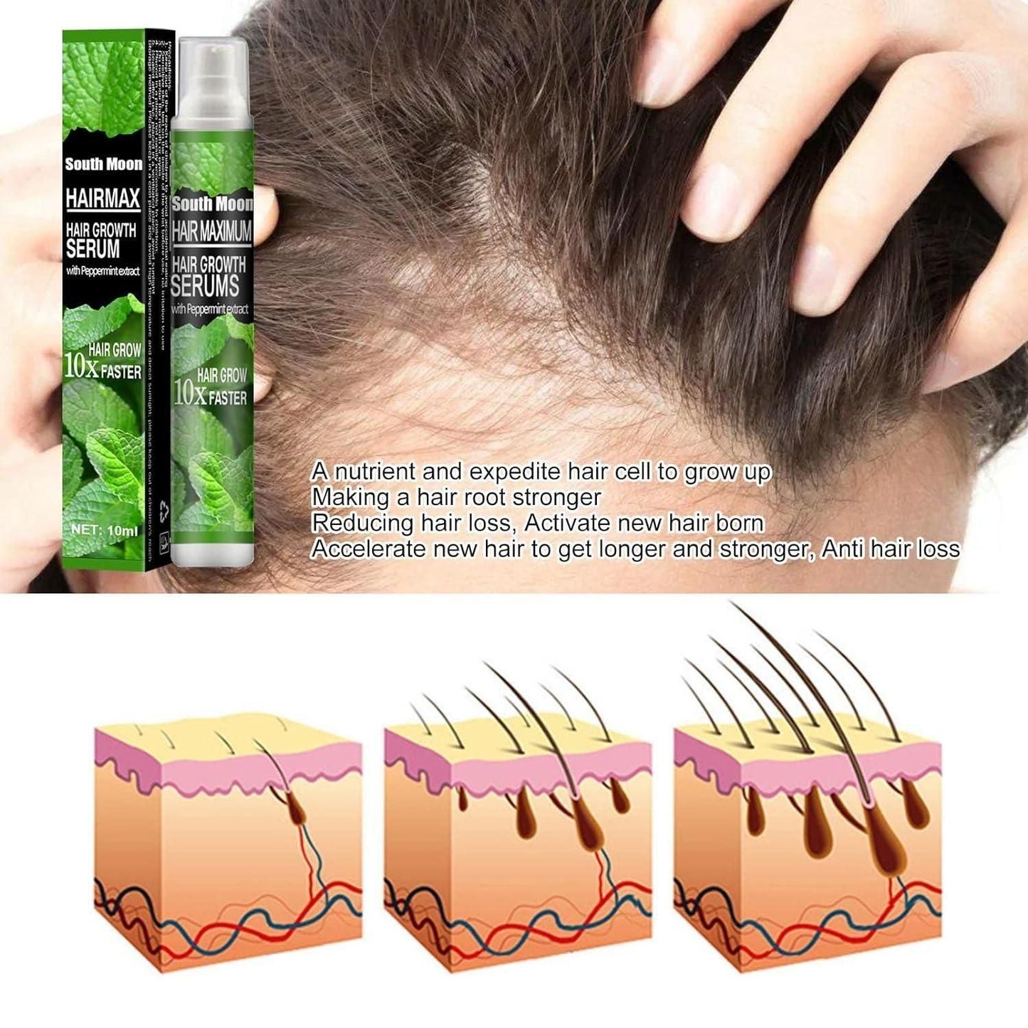 Ginger Plant Extract Anti-Hair Loss Hair Serum BUY 1 GET 1 FREE